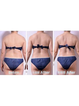 ボディラインを整えたい