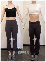 24ダイヤモンドジム(24 DIAMOND GYM)/before/after