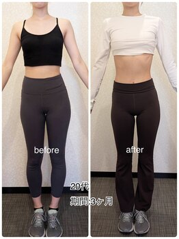 24ダイヤモンドジム(24 DIAMOND GYM)/before/after