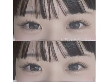 シャイン(SHINE)/