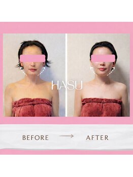 蓮(HASU)の写真/【圧倒的手技×効果実感】オールハンドの独自な技術が効く◆ソフトな本格コルギで理想のフェイスラインへ