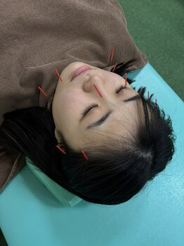 リセット整骨院 布施ほんまち通り院の写真/自費施術を半額で受けられる◎お悩み解決に向けてお客様の私生活に合わせたご提案をいたします♪
