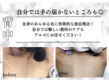 アルゴ 熊本健軍店(ALGO)/【背中】ビフォーアフターご紹介