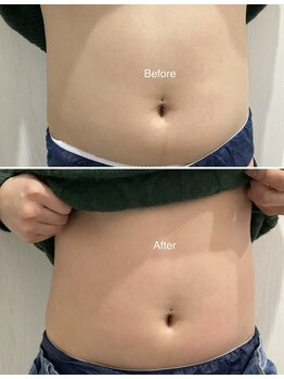 セラス(CERAS)/フォースカッター　お腹30分