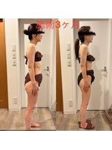 シエル 春日部店(Ciel)/【3ヶ月施術後】