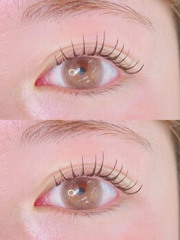 アネラ(ANELA)の写真/小山市初！マツエク×まつパを組み合わせた最先端技術【アンドヘルシー】初回80本10500円～