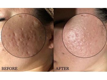 オームの森 北浜/深い窪みも諦めないで!