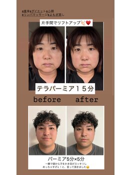 ヨサパーク リアン(YOSA PARK Lien)/モニター様before→after