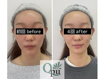 キュープ 鹿児島伊集院店(Qpu)/