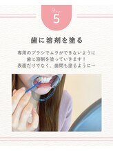 エクシアホワイトニング 天王寺店/ 5.　歯に溶剤（ジェル）を塗る