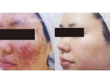 グランツ(glanz)/元エステインストラクターが担当