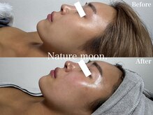 ナチュールムーン(Nature moon.)/ピーリング