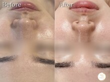 プリュボーテ(Pul Beaute)/毛穴を引き締め素肌に自信を