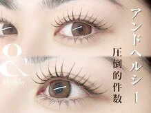 エステ屋の雰囲気(マツエクが影になる方はアンドヘルシーおすすめ♪)