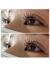 アイリス(Ailis)/