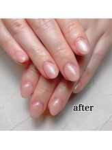 スマイルニコ(smile nico)/即日可愛いネイルになる深爪矯正