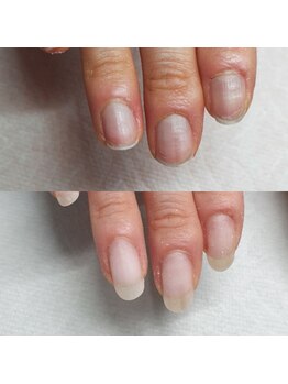 リン 恵比寿(RiN.)/深爪育成 akane