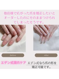 ただ伸ばすだけで良いですか？