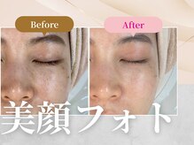 フェルナ 南森町店(FERNA)/フェイシャル