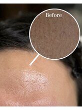 プラスアイビー 沖縄那覇店(+i.b)/自信あるおでこ目指しましょう。