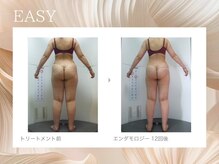 イージー(EASY)/