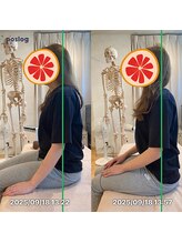 グレフル鍼灸接骨院 整体院 心斎橋/整体/肩こり/マッサージ/腰痛