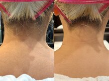 バーバーショップ 難波店(BARBER SHOP)/うなじシェービング
