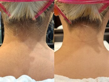 バーバーショップ 難波店(BARBER SHOP)/うなじシェービング