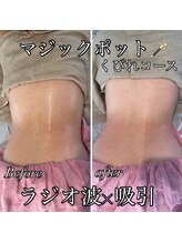 ゆでたまご/究極の健康美