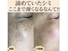 【本気の肌質改善】ハーブピーリング＋シミケア20分