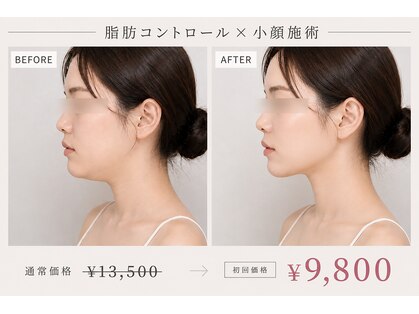 リレイスフクオカ(RelaceFUKUOKA)の写真