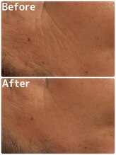 シュシュ 立川駅前(ChouChou)/気になるお目元！