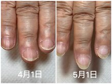 アプリコットネイル(apricot nail)/