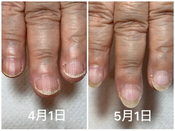 アプリコットネイル(apricot nail)/