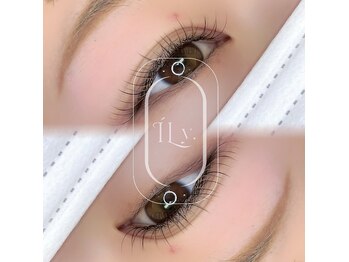 アイリー(ILy)