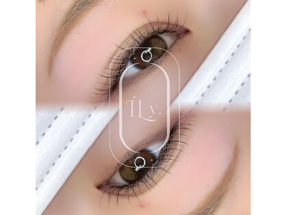 アイリー(ILy)の写真