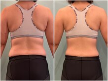 インプルーブ 浜北店(Improve)/2ヶ月結果　30代女性