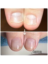 ミリアネイル 成城(Miliea nail)/