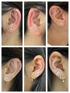 耳つぼジュエリー