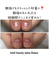 カンナ(Kanna)/5500円