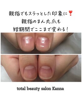 カンナ(Kanna)/5500円