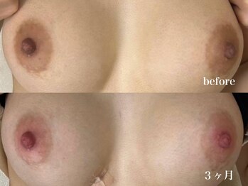 アユーナ(Ayu-Na)/ローマピンク