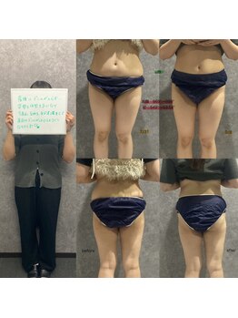 リボーン(REBORN)/産後ケアーダイエット