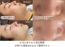 頭のオアシすぱ