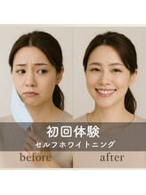 エンコロレ(encolore)