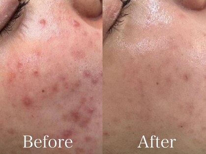 シーベル 小倉の写真