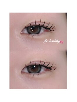 アテケア(ate kea)/
