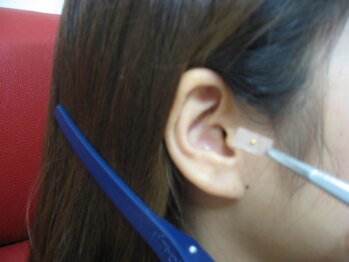 ゲットスマイル/耳ツボ(食事カウンセリング付き)