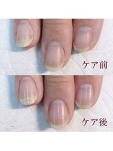 アレス 狛江店(ales)/美爪ケアコース