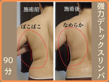 ニース(NICE)/50代/女性/1回の変化